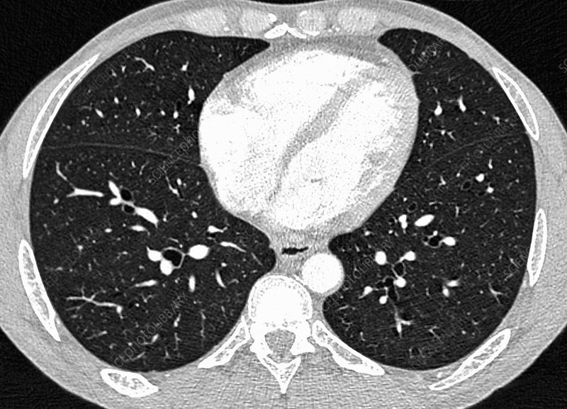 CT Quality Assurance and Protocol Optimization